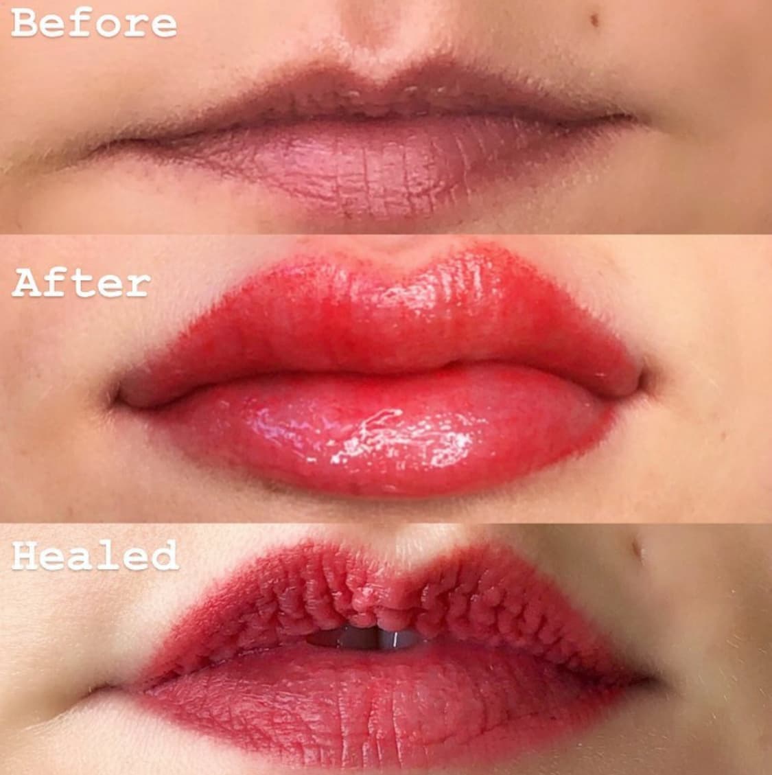 Lip blush healing photos
